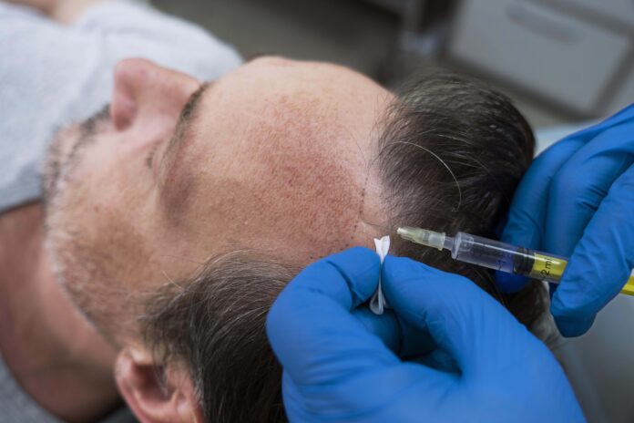 Platelet-rich plasma (PRP)